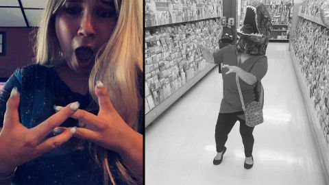 TikTok star with 3 fingers nicknamed dinosaur