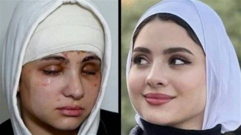 هل فقدت البلوغر سارة محمد بصرها نهائيًا؟