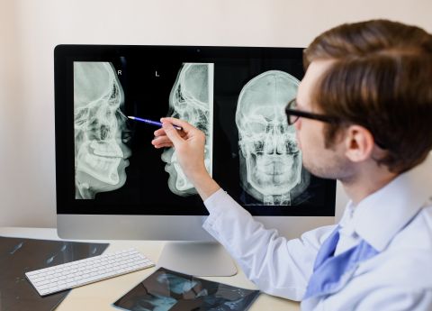 Man discovers broken chopsticks in his skull