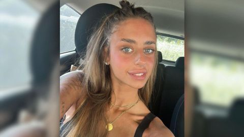 الأسيرة الإسرايلية ميا شيم تخضع لعملية تجميل.. شاهدوا شكلها