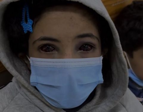 First photo of Amina, Palestinian girl with red eyes, after recovery