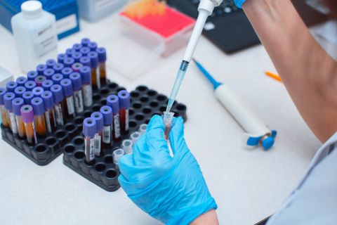 New test reveals Cancer within minutes