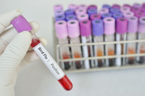 Second U.S. bird flu case, linked to Michigan dairy farm