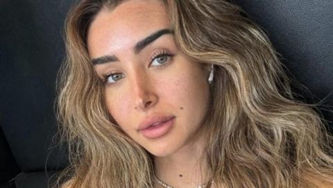 بعد تعرضها للتنمر: هنا الزاهد تخضع لعملية تجميل