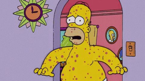 Man with Mpox freely wanders the streets in Paris!