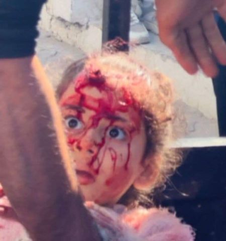 UN urges immediate action to stop Israeli genocide in Gaza