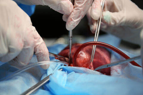Researchers Presently Working in Pig's Heart Transplants Into Humans 