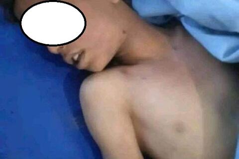 اغتصاب وقتل طفل في تعز اليمنية الخاضعة لسيطرة الحوثيين